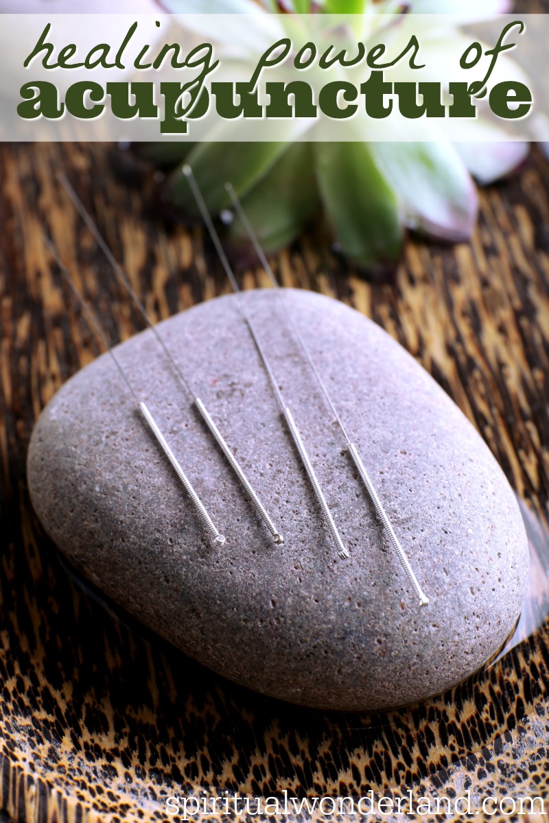 Are you curious what health benefits acupuncture can offer? The points of these thin needles are used for fertility, in pregnancy, for weight loss, for anxiety, for back pain, for headaches and more.